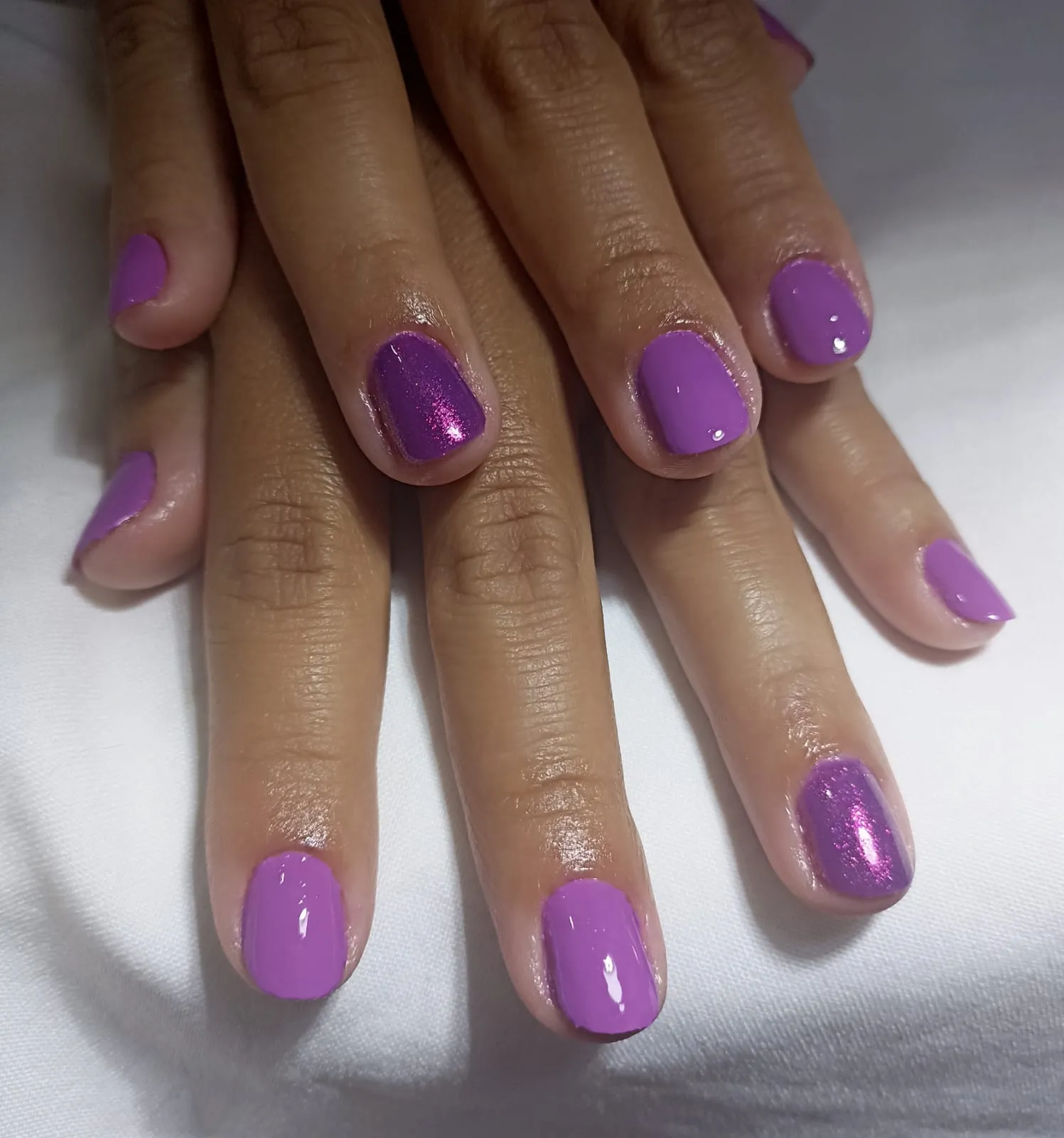 unhas