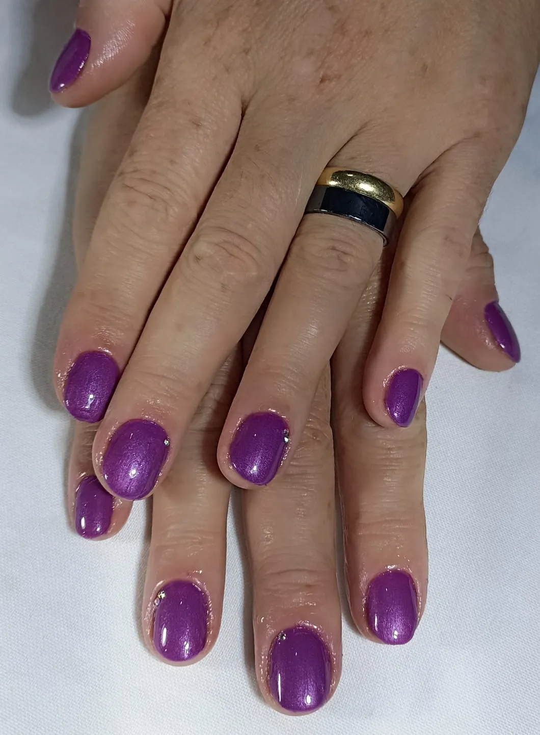 unhas